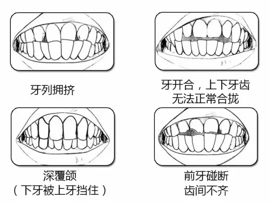 QQ截图20170117135911.png