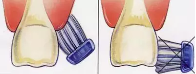QQ截图20170117165813.png