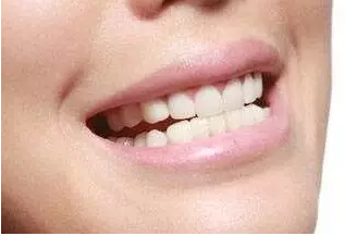 QQ截图20170330151438.png
