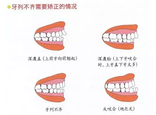 QQ截图20170419162239.png