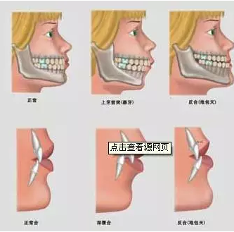 QQ截图20170419162400.png