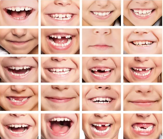首页> 健康常识 > 儿童保健 换牙如"换脸",带来新改变.